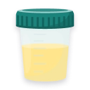 Urine Test